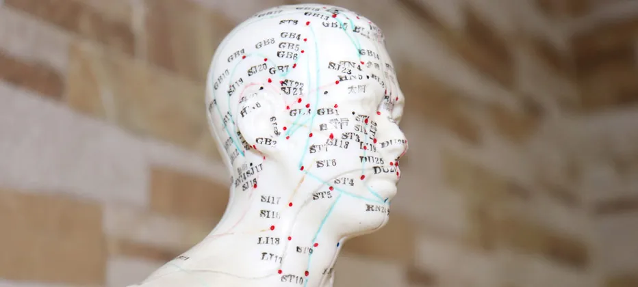 acupuntura para parkinson permanente es bueno la acupuntura para parkinson