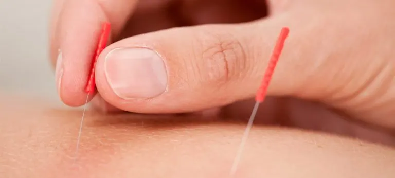 Acupuntura para enfermedades neurológicas