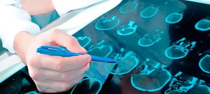 Centro de Medicina Neuro-regenerativa y la Auriculopuntura con el Día Mundial de la Salud