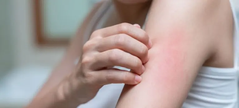 ¿Cómo puede afectar el parkinson en la piel?