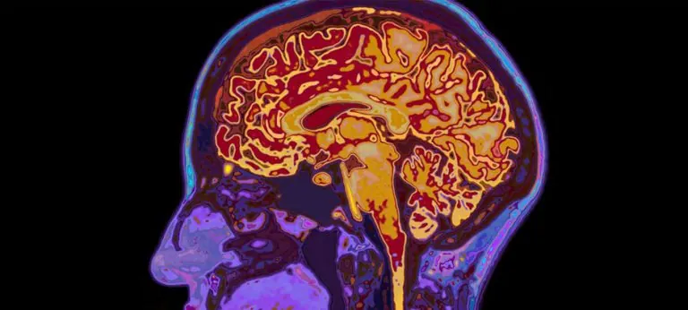 Causas de la epilepsia