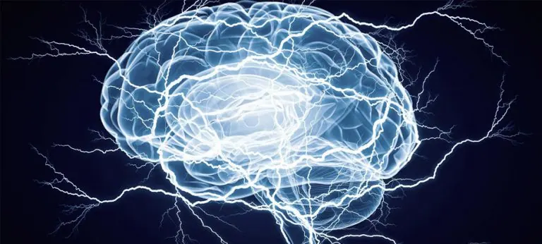 Epilepsia Tratamiento