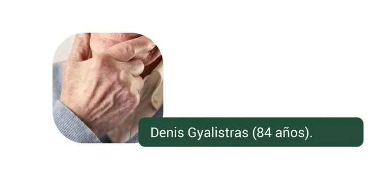 La aguja permanente – Informe de un tratamiento frente a la enfermedad de Alzheimer-Demencia