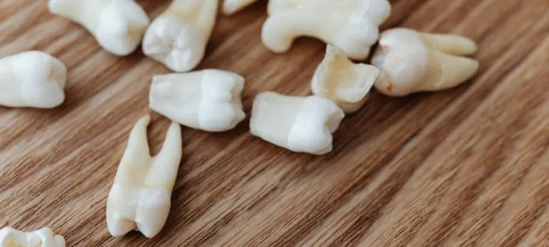 La pérdida de dientes en el Alzheimer