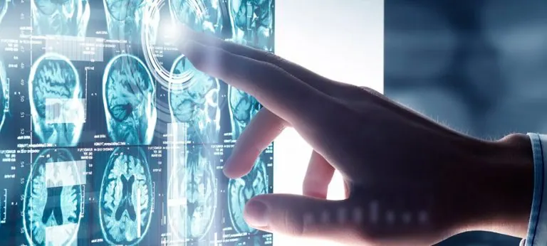 ¿Por qué se origina el Parkinson?
