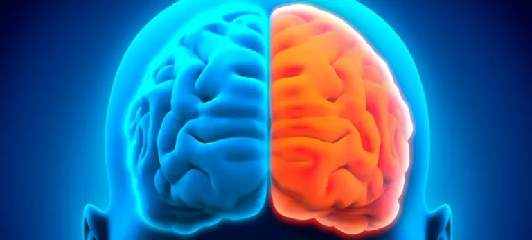¿Qué parte del cerebro se ve afectada por el Alzheimer?
