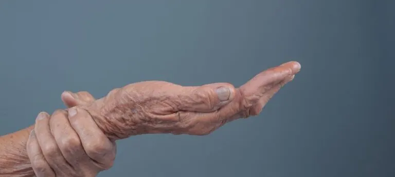 ¿Cómo afecta el síndrome de la mano ajena al párkinson?