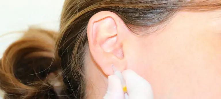 Tratamiento basado en la auriculoterapia frente a la Esclerosis Múltiple
