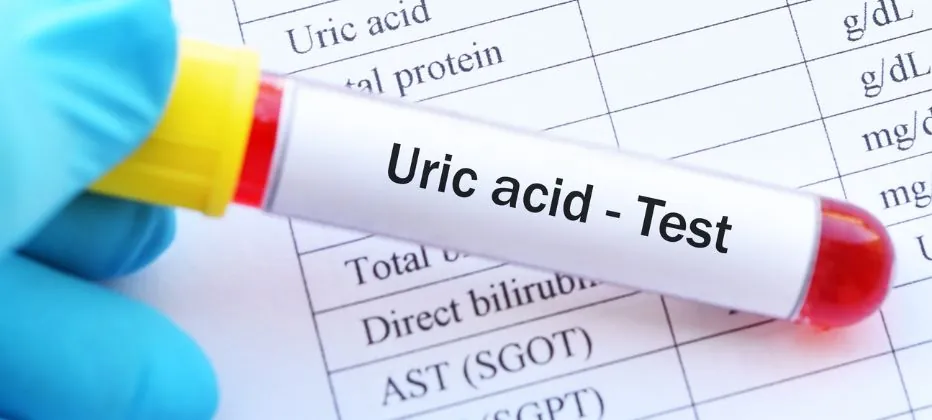 que es el acido urico y en que alimentos lo podemos encontrar que es el acido urico y en que alimentos lo podemos encontrar