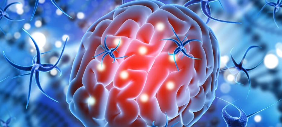 dana el parkinson la sustancia negra dana el parkinson la sustancia negra